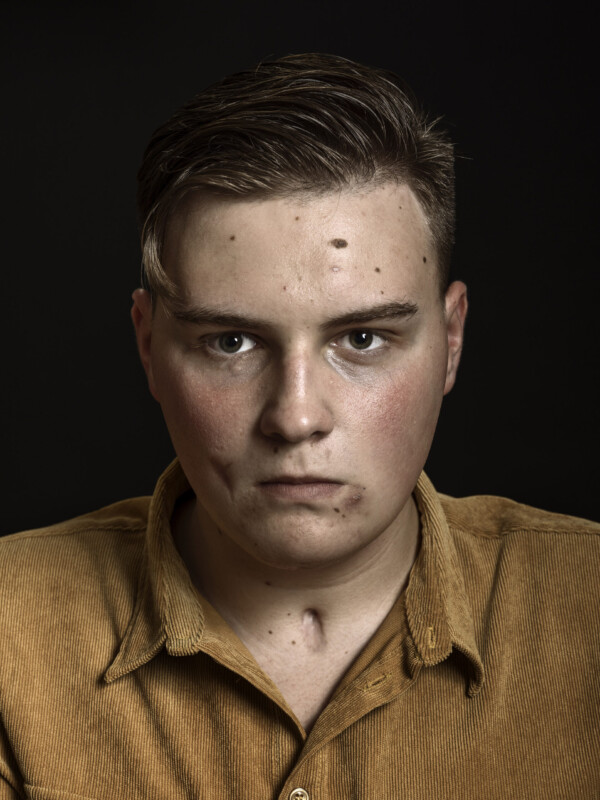 Adam Lawler,
Student,
Survivor of Manchester O2 Arena Attack 22.5.2017,
Manchester, GB