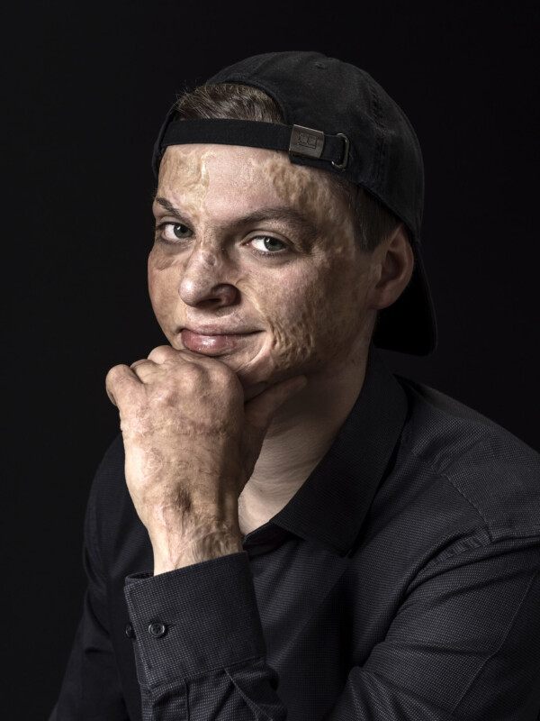 Adrian Esper,
Student (Psychology),
Survivor of attack on Al-Ghriba-Synagogue, 11 April 2002, when 3 years old,
Lünen, Germany