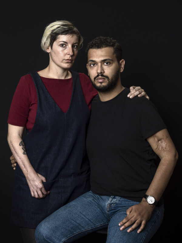 Chloé De Bacco and Mahdi Zaidi,
Survivor of terror attacks in Bataclan (Chloe) and survivor of terror attacks at Le Carillon (Mahdi).
They met in rehabilitation and are a couple now.
Paris, France